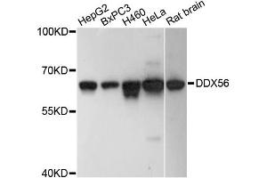 Western blot analysis of extracts of various cell lines, using DDX56 antibody. (DDX56 抗体)