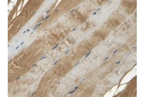 Detection of APOB in Rat Skin Tissue using Polyclonal Antibody to Apolipoprotein B (APOB) (APOB 抗体  (AA 2747-2913))