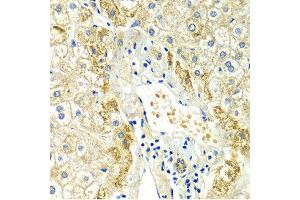 Immunohistochemistry of paraffin-embedded Human liver injury using ERG antibody at dilution of 1:100 (x400 lens). (ERG 抗体  (AA 1-280))