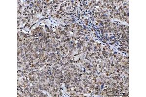 IHC analysis of UBA6 using anti-UBA6 antibody (ABIN7602559).