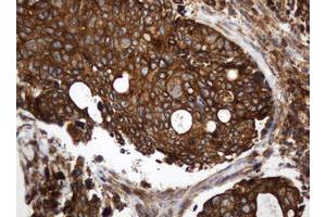Image no. 1 for anti-TAP Binding Protein-Like (TAPBPL) antibody (ABIN1501302) (TAPBPL 抗体)