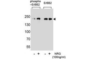 Western blot analysis of extracts from SK-BR-3 cell, untreated or treated with NRG, using phospho-ErbB2 (left) or nonphos Ab (right). (ErbB2/Her2 抗体  (pTyr1140))