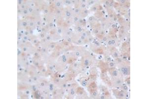 Used in DAB staining on fromalin fixed paraffin- embedded Kidney tissue (VAV1 抗体  (AA 426-696))