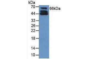 Western Blotting (WB) image for Collagen, Type X (COL10) ELISA Kit (ABIN6574302)