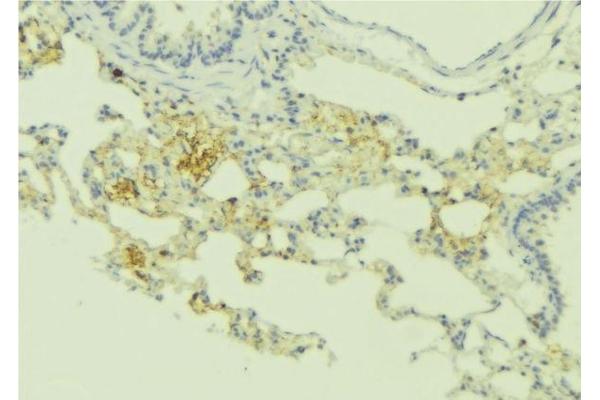 RRAD 抗体  (Internal Region)