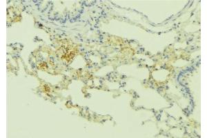 ABIN6275172 at 1/100 staining Human lung tissue by IHC-P. (RRAD 抗体  (Internal Region))