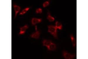 ABIN6274366 staining Hela by IF/ICC. (SURF1 抗体  (Internal Region))