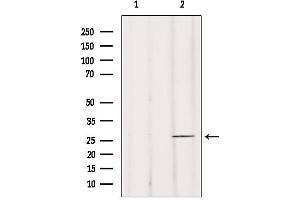Western blot analysis of extracts from mouse brain, using BRMS1 Antibody. (BRMS1 抗体  (N-Term))