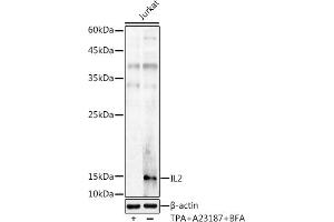 Western blot analysis of extracts of Jurkat cells, using IL2 antibody (ABIN3020908, ABIN3020909, ABIN3020910 and ABIN6213790) at 1:1000 dilution. (IL-2 抗体  (AA 21-153))