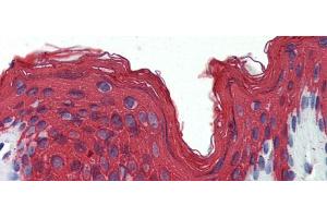 Rabbit Anti-KRT1 Antibody  arp42278 Paraffin Embedded Tissue: Human Skin Antibody Concentration: 1. (Cytokeratin 1 抗体  (Middle Region))