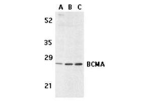 Western blot analysis of BCMA in human spleen (A) tissue lysate, K562 (B), and U937 (C) cell lysates with AP30133PU-N BCMA antibody at 5 μg/ml. (BCMA 抗体)