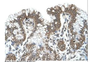 POFUT2 antibody was used for immunohistochemistry at a concentration of 4-8 ug/ml. (POFUT2 抗体  (C-Term))