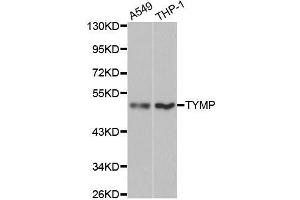 Western blot analysis of extracts of various cell lines, using TYMP antibody. (Thymidine Phosphorylase 抗体  (AA 1-200))