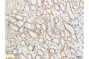 Formalin-fixed and paraffin embedded mouse kidney labeled with Rabbit Anti-APG5L/ATG5 Polyclonal Antibody (ABIN752413) at 1:100 followed by conjugation to the secondary antibody and DAB staining. (ATG5 抗体  (AA 101-200))