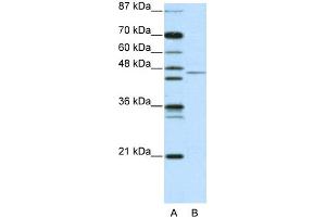WB Suggested Anti-TRIM14 Antibody   Titration: 2.