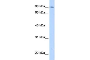 WB Suggested Anti-TMEM24 Antibody Titration:  0. (C2CD2L 抗体  (C-Term))