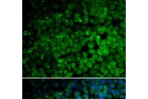 Immunofluorescence analysis of HeLa cells using TRIM13 Polyclonal Antibody (TRIM13 抗体)
