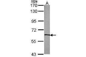 Western Blotting (WB) image for anti-Neurotrophic tyrosine Kinase, Receptor, Type 3 (NTRK3) (Internal Region) antibody (ABIN2855417)