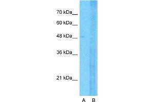 Western Blotting (WB) image for anti-Solute Carrier Family 12 (Sodium/potassium/chloride Transporters), Member 1 (SLC12A1) (N-Term) antibody (ABIN2776780)