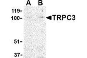 Western blot analysis of TRPC3 in mouse heart tissue lysate with this product at (A) 1 and (B) 2 μg/ml. (TRPC3 抗体  (N-Term))