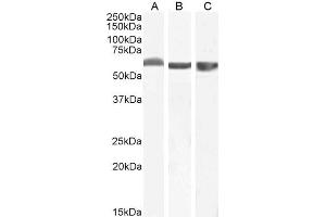 Western Blotting (WB) image for anti-Formiminotransferase Cyclodeaminase (FTCD) (Internal Region) antibody (ABIN185268)