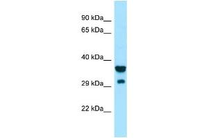 Western Blotting (WB) image for anti-Signal-Regulatory Protein gamma (SIRPG) (Middle Region) antibody (ABIN2790197) (SIRPG 抗体  (Middle Region))