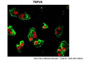 Immunohistochemistry (IHC) image for anti-Transient Receptor Potential Cation Channel, Subfamily V, Member 6 (TRPV6) (Middle Region) antibody (ABIN2776225)