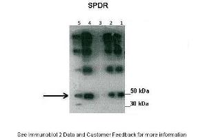 Lanes:   Lane1: 30 ug human placental tissue lysate Lane2: 30 ug human placental tissue lysate Lane3: 30 ug human placental tissue lysate Lane4: 30 ug human placental tissue lysate Lane5: 20 ug human myometrial tissue lysate  Primary Antibody Dilution:   1:500  Secondary Antibody:   Goat anti-rabbit HRP  Secondary Antibody Dilution:   1:10000  Gene Name:   SDPR  Submitted by:   Hiten Mistry, Ania Czajka and Marta Hentschke Ribeiro, King's College London (SDPR 抗体  (N-Term))