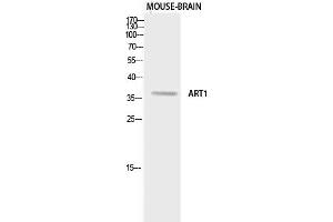 Western Blotting (WB) image for anti-ADP-Ribosyltransferase 1 (ART1) antibody (ABIN5958873) (ART1 抗体)