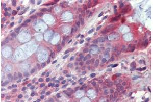 Colon, Human: Formalin-Fixed, Paraffin-Embedded (FFPE) (TPCN2 抗体  (AA 735-747))