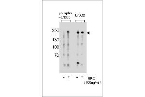 Western blot analysis of extracts from T47D cells, untreated or treated with NRG, 100 ng/mL, using phospho-ErBB2 (left) or ErBB2 Antibody (right). (ErbB2/Her2 抗体  (pTyr877))