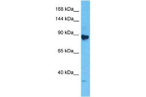 Host:  Rabbit  Target Name:  MCM6  Sample Type:  Jurkat Whole Cell lysates  Antibody Dilution:  1. (MCM6 抗体  (Middle Region))