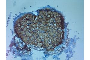 Immunohistochemistry (IHC) image for anti-Neurotrophic tyrosine Kinase, Receptor, Type 3 (NTRK3) antibody (ABIN351087)