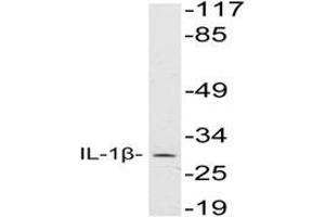 Western blot analysis of IL-1B Antibody in extracts from HeLa cells. (IL-1 beta 抗体)