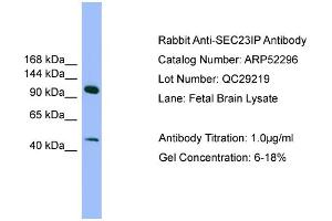 WB Suggested Anti-SEC23IP  Antibody Titration: 0. (SEC23IP 抗体  (N-Term))