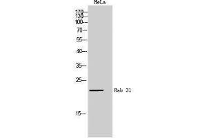Western Blotting (WB) image for anti-RAB31, Member RAS Oncogene Family (RAB31) (Internal Region) antibody (ABIN3177069) (RAB31 抗体  (Internal Region))