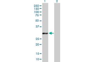 Western Blot analysis of GCLM expression in transfected 293T cell line by GCLM MaxPab polyclonal antibody. (GCLM 抗体  (AA 1-274))