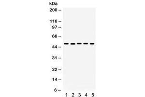 Western blot testing of 1) rat brain, 2) rat kidney, 3) human placenta, 4) HeLa, 5) A431 lysate with Galectin 8 antibody. (LGALS8 抗体)