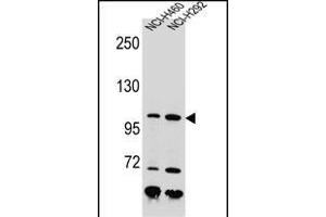 NBN Antibody (C-term) (ABIN655721 and ABIN2845169) western blot analysis in NCI-,NCI- cell line lysates (35 μg/lane). (Nibrin 抗体  (C-Term))