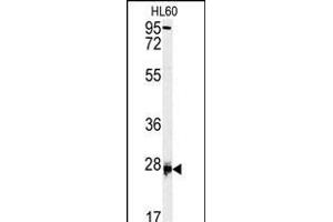 Western blot analysis of DPT antibody (Center) (ABIN391701 and ABIN2841600) in HL60 cell line lysates (35 μg/lane). (Dermatopontin 抗体  (AA 102-128))