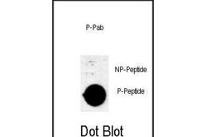Dot blot analysis of anti-Phospho-AKT1 (Thr308) Antibody Phospho-specific Pab (ABIN650880 and ABIN2839823) on nitrocellulose membrane. (AKT1 抗体  (pThr308))