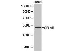 Western Blotting (WB) image for anti-CASP8 and FADD-Like Apoptosis Regulator (CFLAR) antibody (ABIN1871811) (FLIP 抗体)