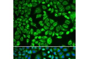 Immunofluorescence analysis of MCF-7 cells using PSMD7 Polyclonal Antibody (PSMD7 抗体)