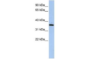 Western Blotting (WB) image for anti-Family with Sequence Similarity 84, Member A (FAM84A) antibody (ABIN2459583) (FAM84A 抗体)