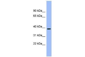 Human kidney; WB Suggested Anti-ACMSD Antibody Titration: 0. (ACMSD 抗体  (Middle Region))