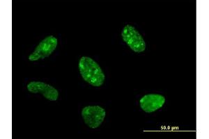 Immunofluorescence of monoclonal antibody to POLR1C on HeLa cell. (POLR1C 抗体  (AA 1-346))