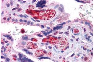 Human Placenta: Formalin-Fixed, Paraffin-Embedded (FFPE) (Liver Arginase 抗体  (N-Term))
