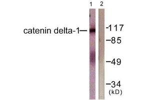 Western Blotting (WB) image for anti-Catenin (Cadherin-Associated Protein), delta 1 (CTNND1) (Tyr228) antibody (ABIN1848016) (CTNND1 抗体  (Tyr228))