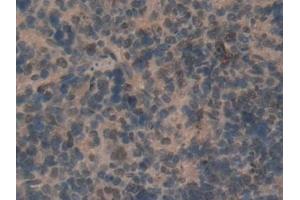 Detection of CD2AP in Rat Spleen Tissue using Polyclonal Antibody to CD2 Associated Protein (CD2AP)
