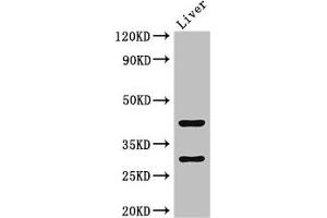 Western Blot Positive WB detected in: Mouse liver tissue All lanes: TIMD4 antibody at 2 μg/mL Secondary Goat polyclonal to rabbit IgG at 1/50000 dilution Predicted band size: 42, 39 kDa Observed band size: 42, 30 kDa (TIMD4 抗体  (AA 134-301))